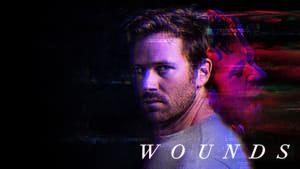 Wounds