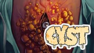 Cyst
